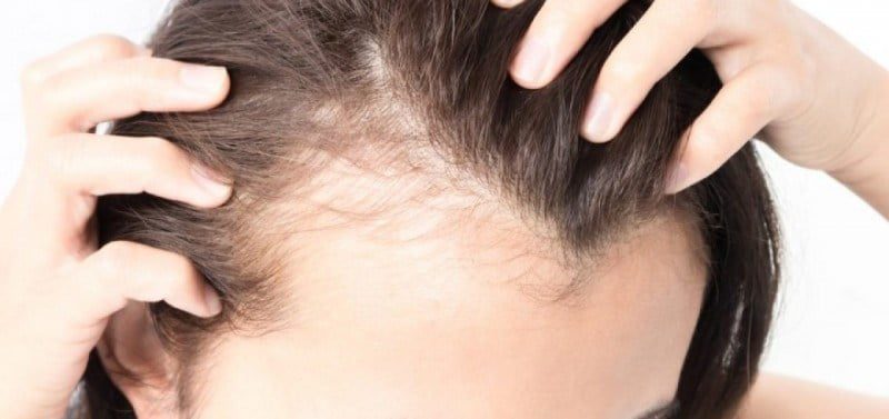 Queda de cabelo: 3 remédios caseiros simples para prevenir o enfraquecimento do cabelo