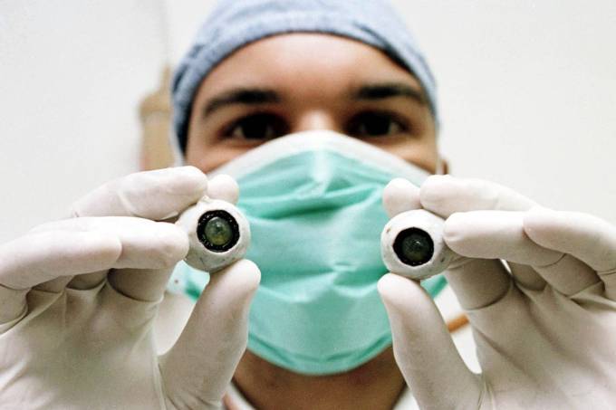 Primeiro transplante de córnea artificial do mundo restaura visão de homem cego