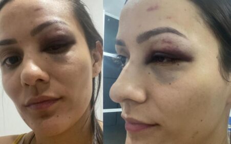 Enfermeira denuncia servidor do Tribunal de Justiça Piauí agressão