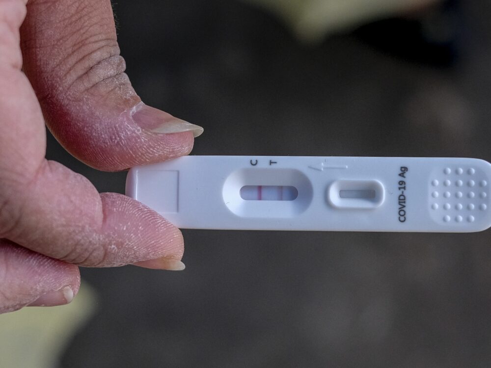 Casos de Covid-19 aumentam 60,6% em Pernambuco e passam de 2,4 mil em uma semana
